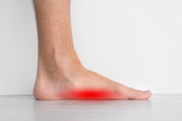 An Overview of Flat Feet