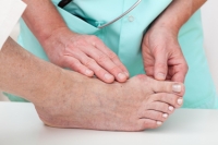 Risks of Having Bunion Surgery